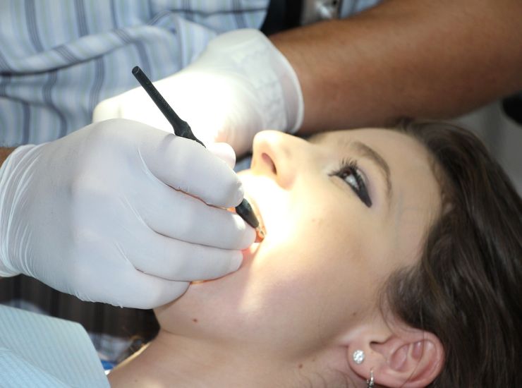 puizia dei denti