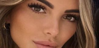 Diastasi addominale che cos'è e come si cura la patologia di Noemi Bocchi
